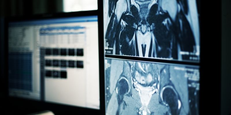 ai-in-healthcare