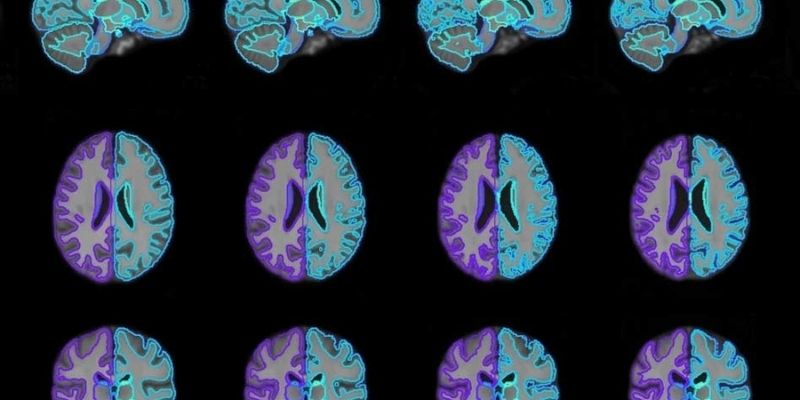 ai for cancer detection